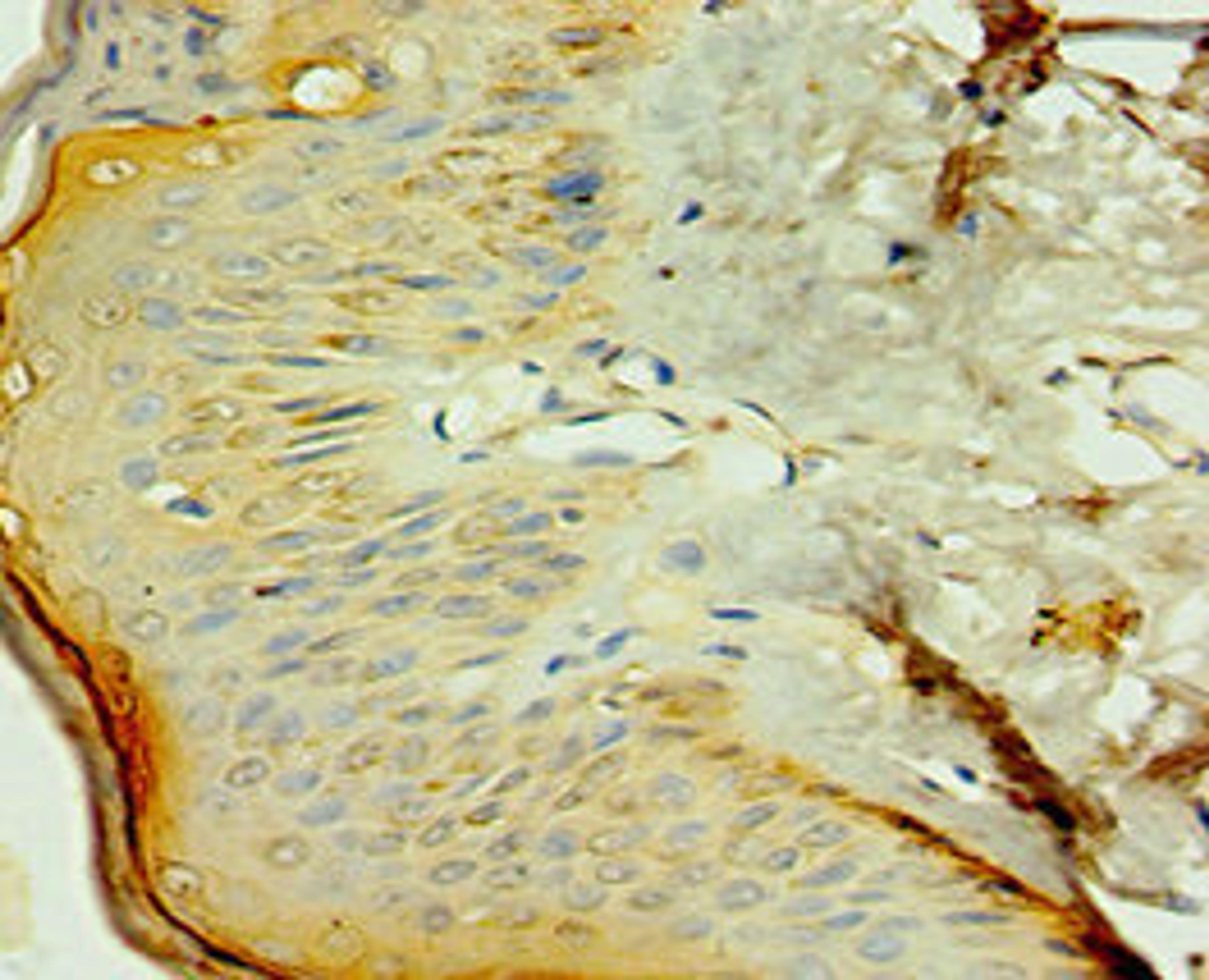 Immunohistochemistry of paraffin-embedded human skin tissue using CSB-PA016052ESR1HU at dilution of 1:100