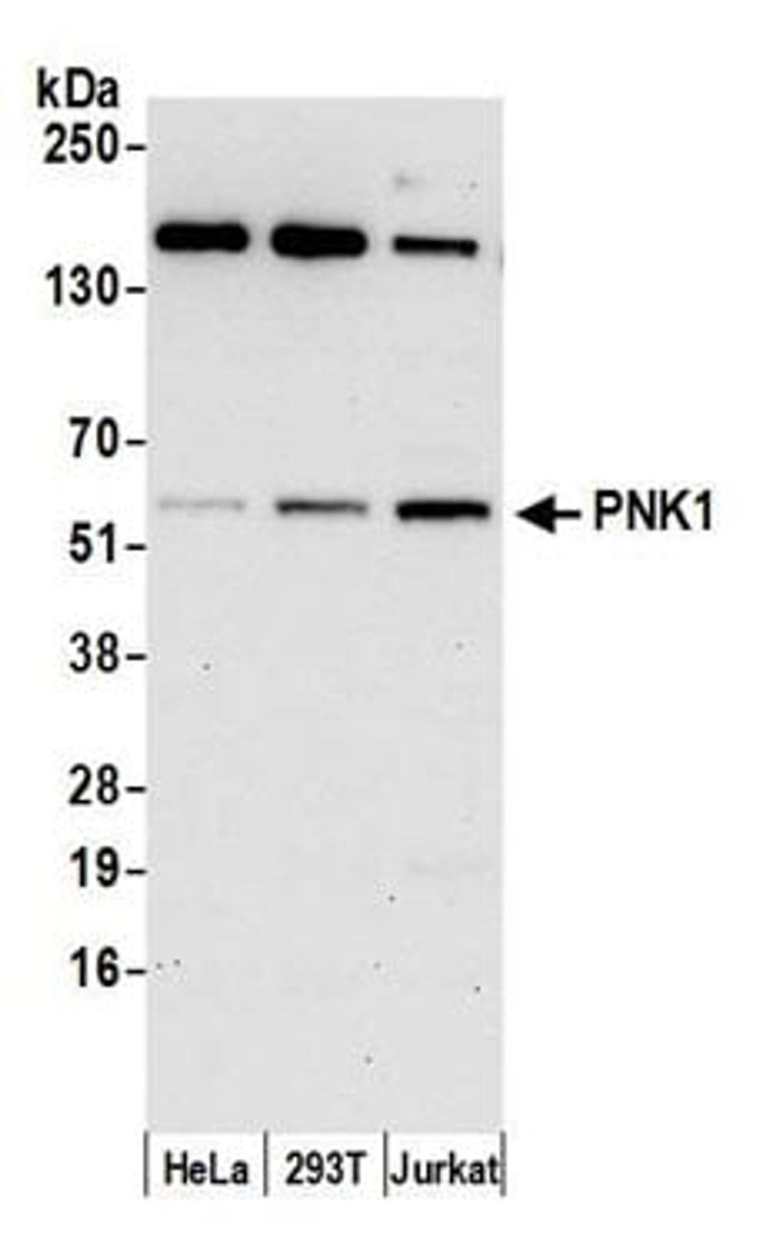 Detection of human PNK1 by western blot.