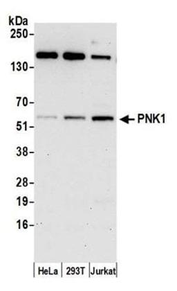 Detection of human PNK1 by western blot.