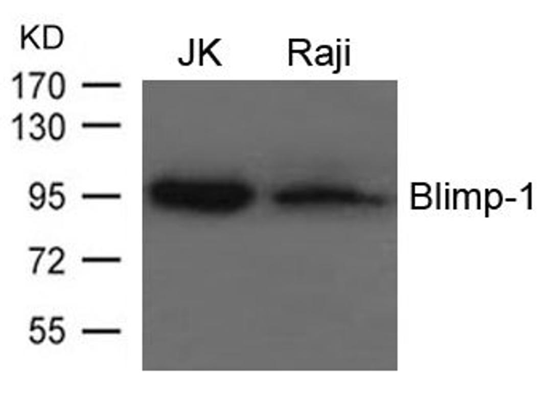 Western blot analysis of JK and Raji cells using Blimp-1 antibody