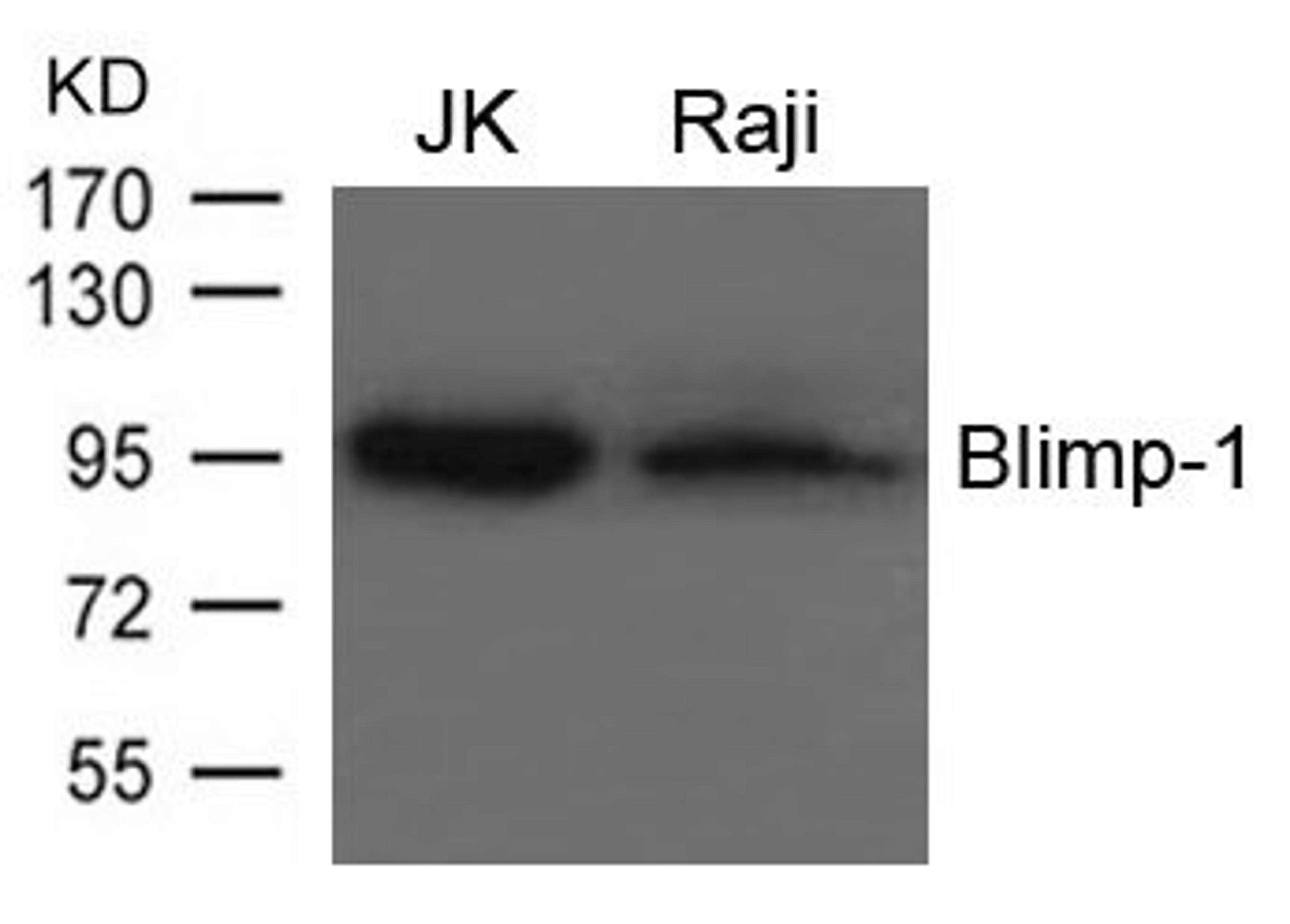 Western blot analysis of JK and Raji cells using Blimp-1 antibody