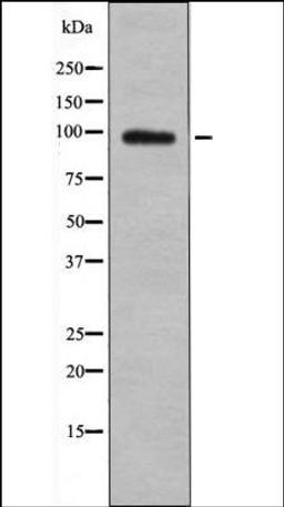 Western blot analysis of PMA treated HeLa whole cell lysates using BL-CAM -Phospho-Tyr842- antibody