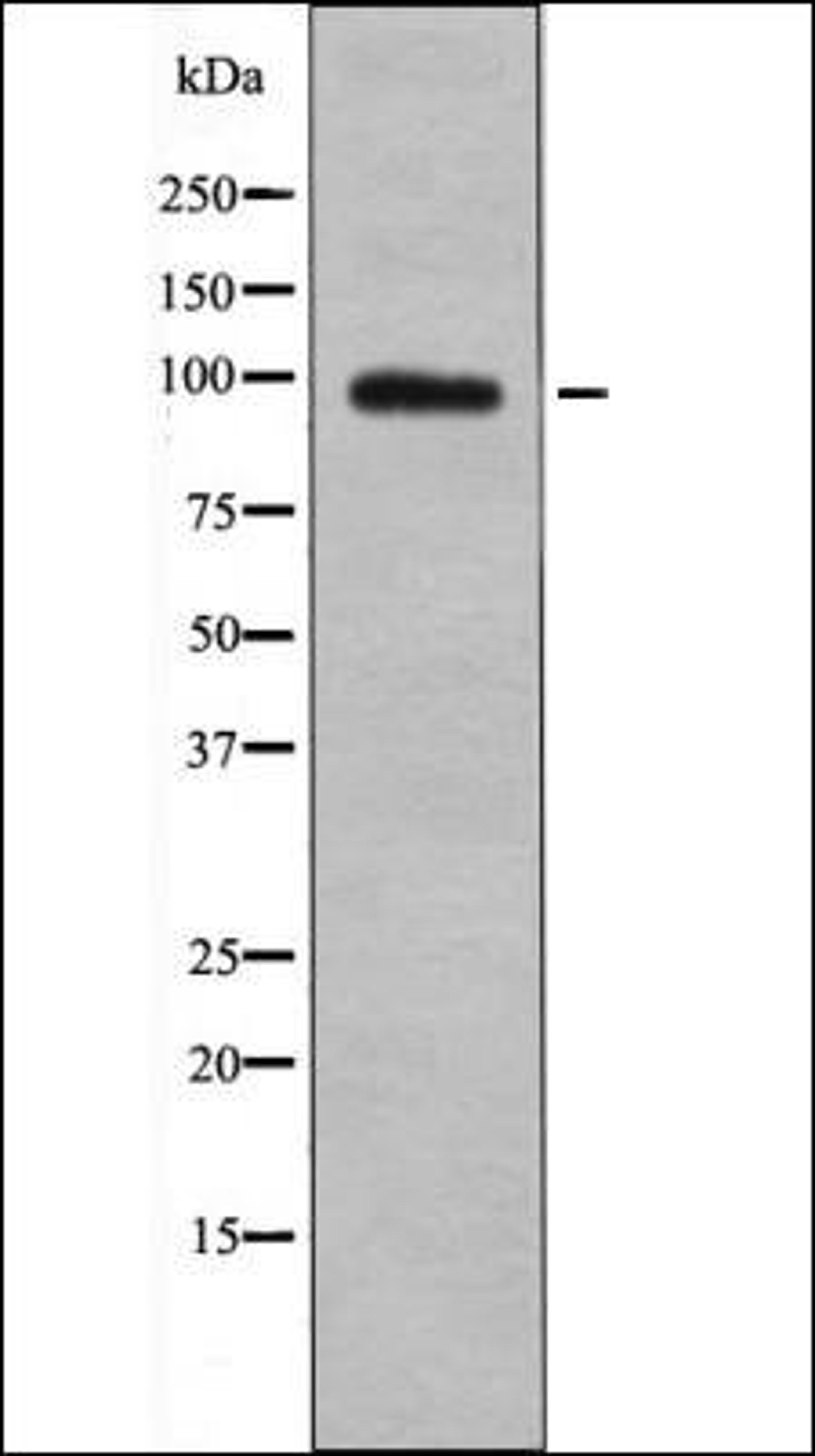 Western blot analysis of PMA treated HeLa whole cell lysates using BL-CAM -Phospho-Tyr842- antibody