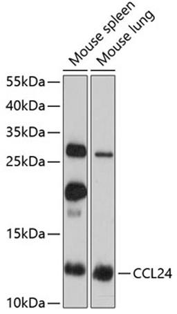 Western blot - CCL24 antibody (A2684)