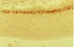 Immunohistochemistry: Reelin Antibody (G10) [NB600-1081] - Mouse anti-Reelin staining of embryonic cerebral cortex at 15 days in utero, with the pial surface above and the ventricle below. The positive zone is the Cajal-Retzius cell layer in the marginal zone, positive for reelin using NB600-1081.