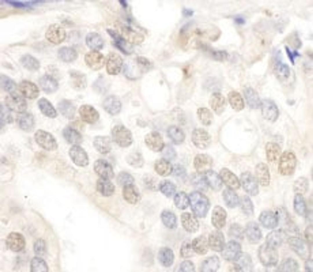 Detection of human E2F4 by immunohistochemistry.