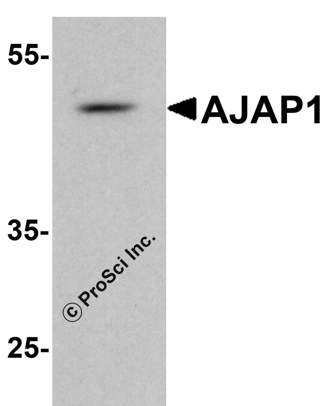 Western blot analysis of AJAP1 in rat liver tissue lysate with AJAP1 antibody at 1 μg/ml.