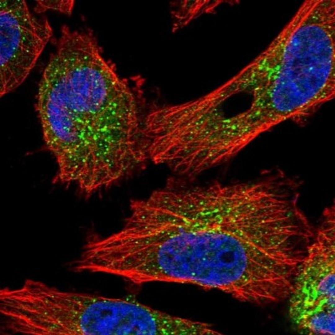 Immunocytochemistry/Immunofluorescence: C20orf196 Antibody [NBP1-82062] - Staining of human cell line U-251 MG shows positivity in endoplasmic reticulum & vesicles.