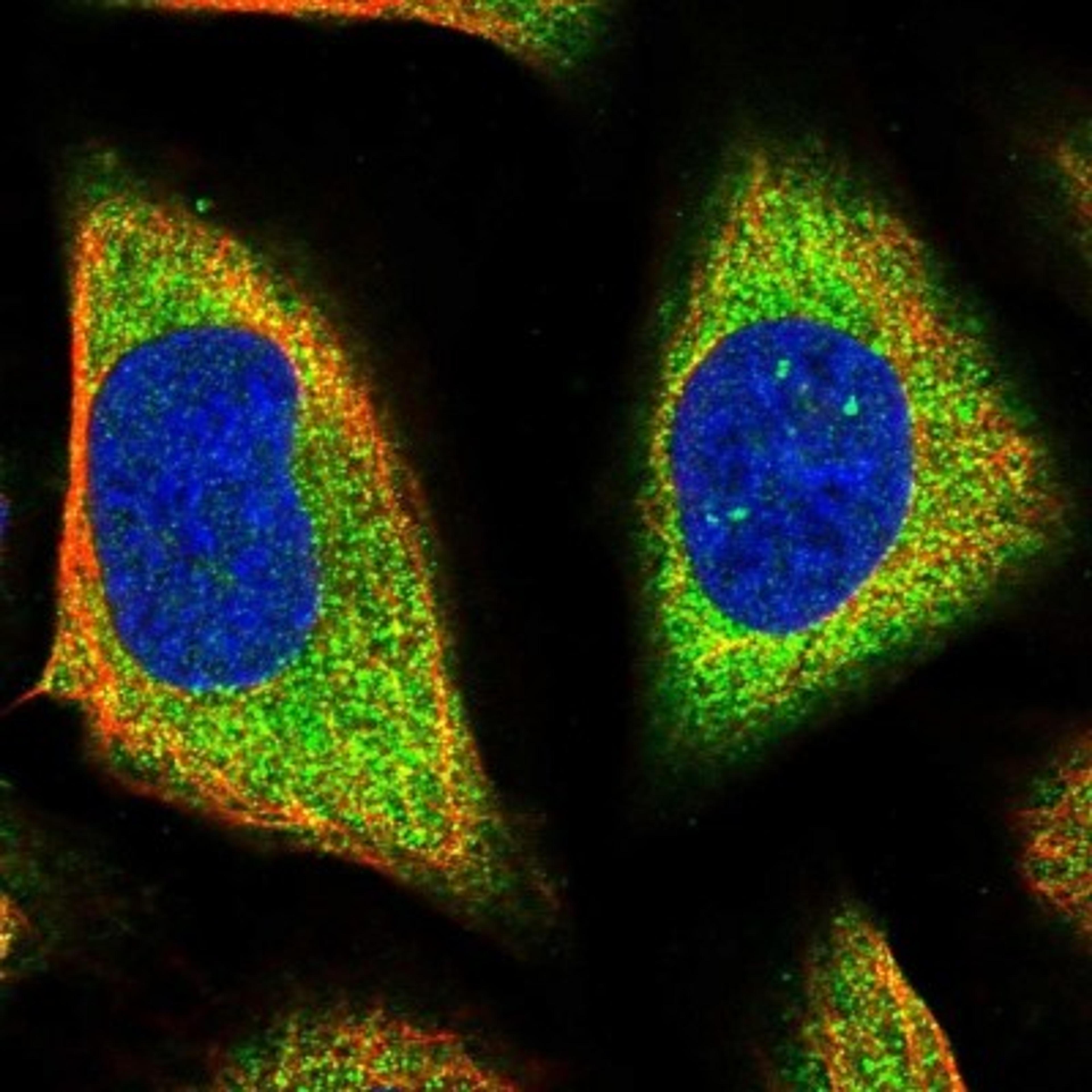 Immunocytochemistry/Immunofluorescence: HSD29 Antibody [NBP1-81100] - Staining of human cell line U-2 OS shows positivity in cytoplasm.