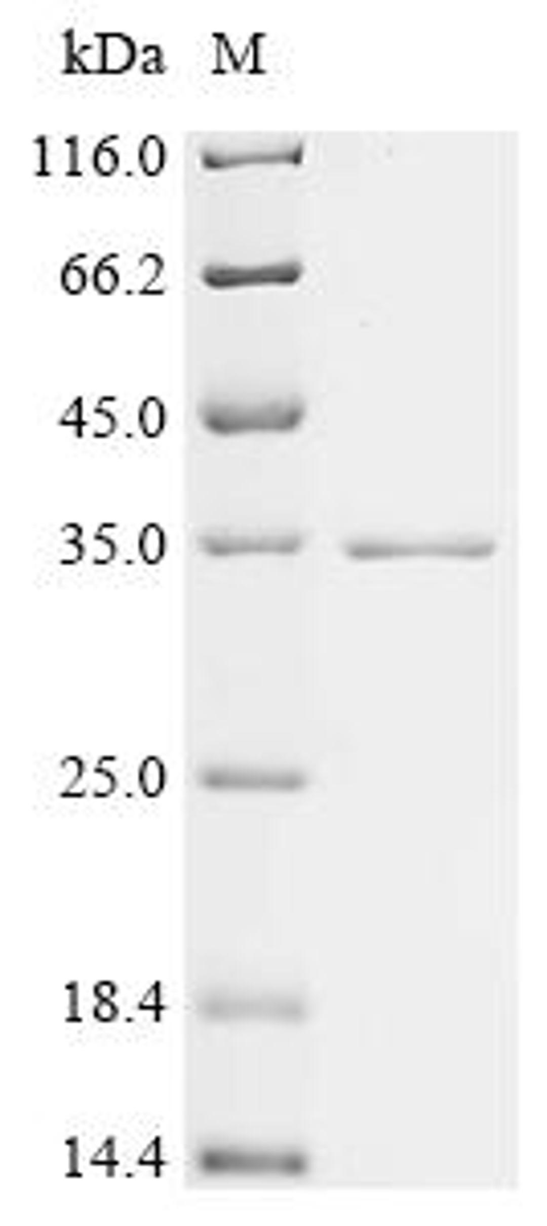(Tris-Glycine gel) Discontinuous SDS-PAGE (reduced) with 5% enrichment gel and 15% separation gel.