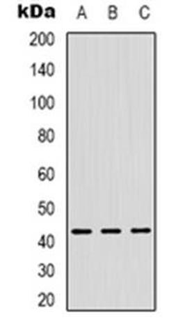 Western blot analysis of ZNF24 expression in Hela (Lane 1), Jurkat (Lane 2), HUVEC (Lane 3) whole cell lysates using ZNF24 antibody