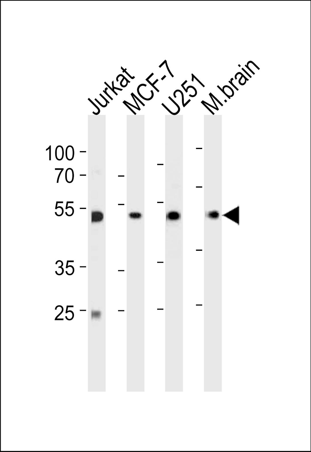 Western blot analysis in Jurkat,MCF-7,U251 cell line and mouse brain tissue lysates (35ug/lane).