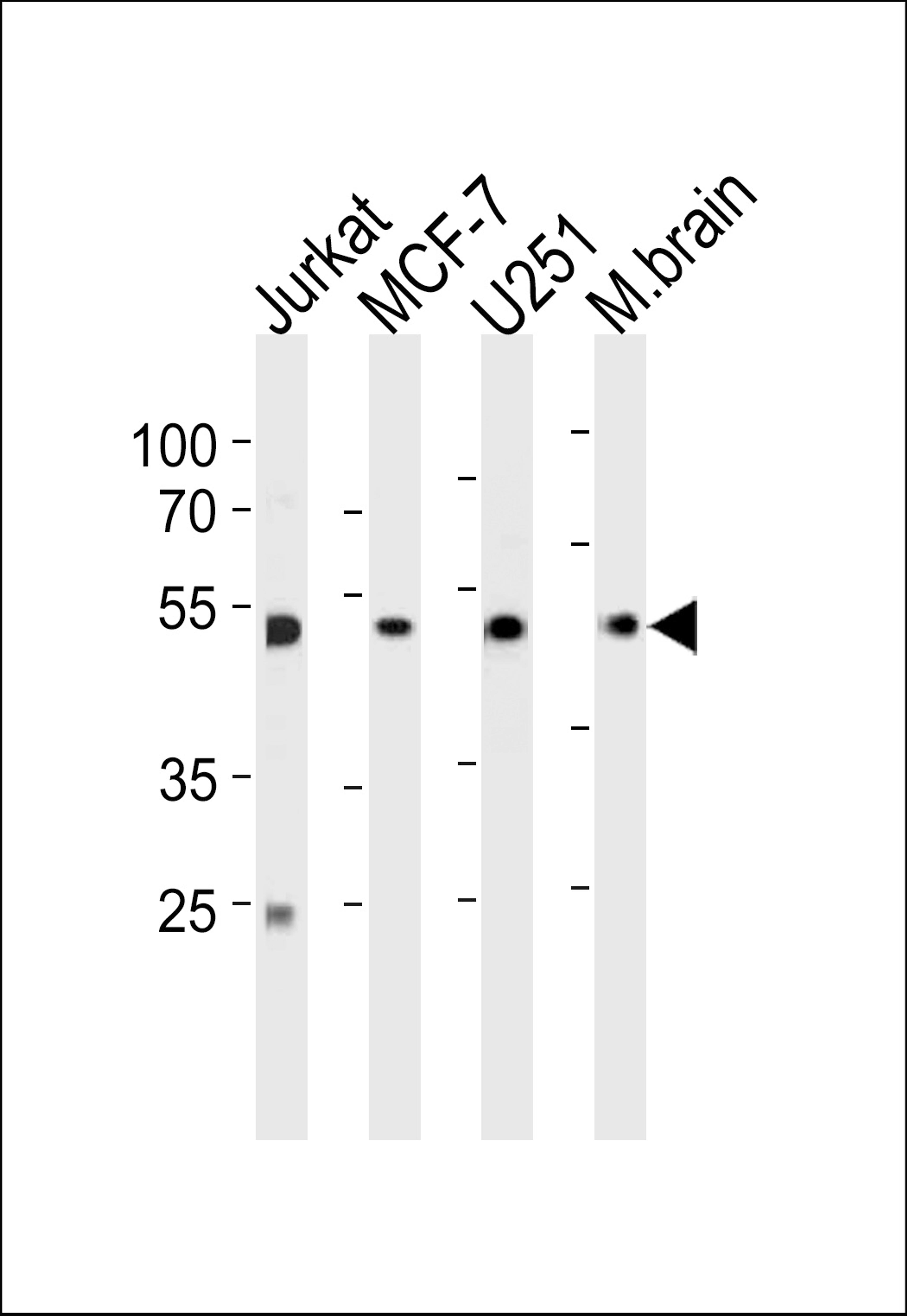 Western blot analysis in Jurkat,MCF-7,U251 cell line and mouse brain tissue lysates (35ug/lane).