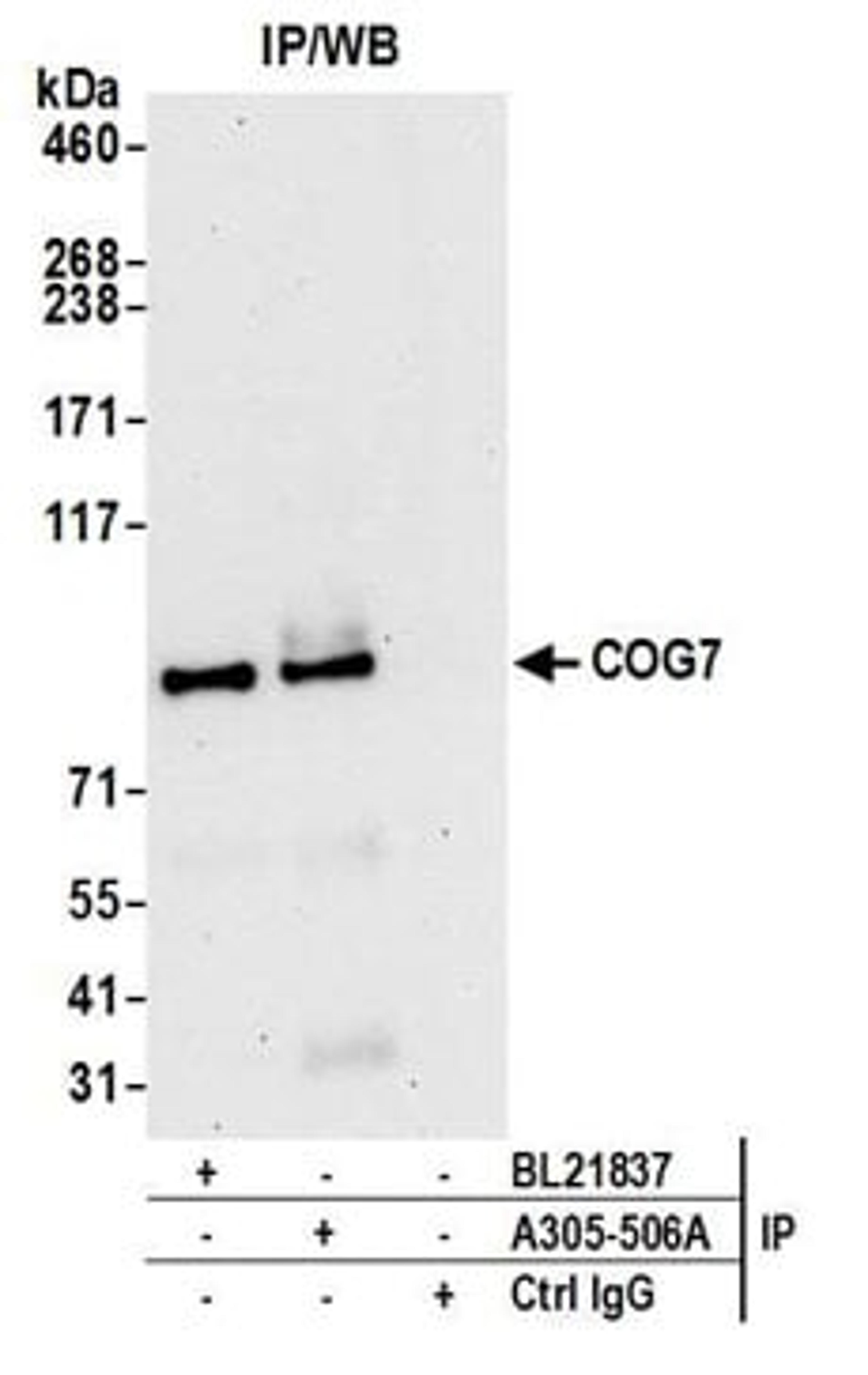 Detection of human COG7 by western blot of immunoprecipitates.