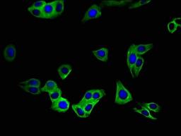 Immunofluorescense analysis of hepG2 cells using SLC52A3 antibody