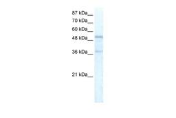 Antibody used in WB on Human HepG2 at 5.0 ug/ml.