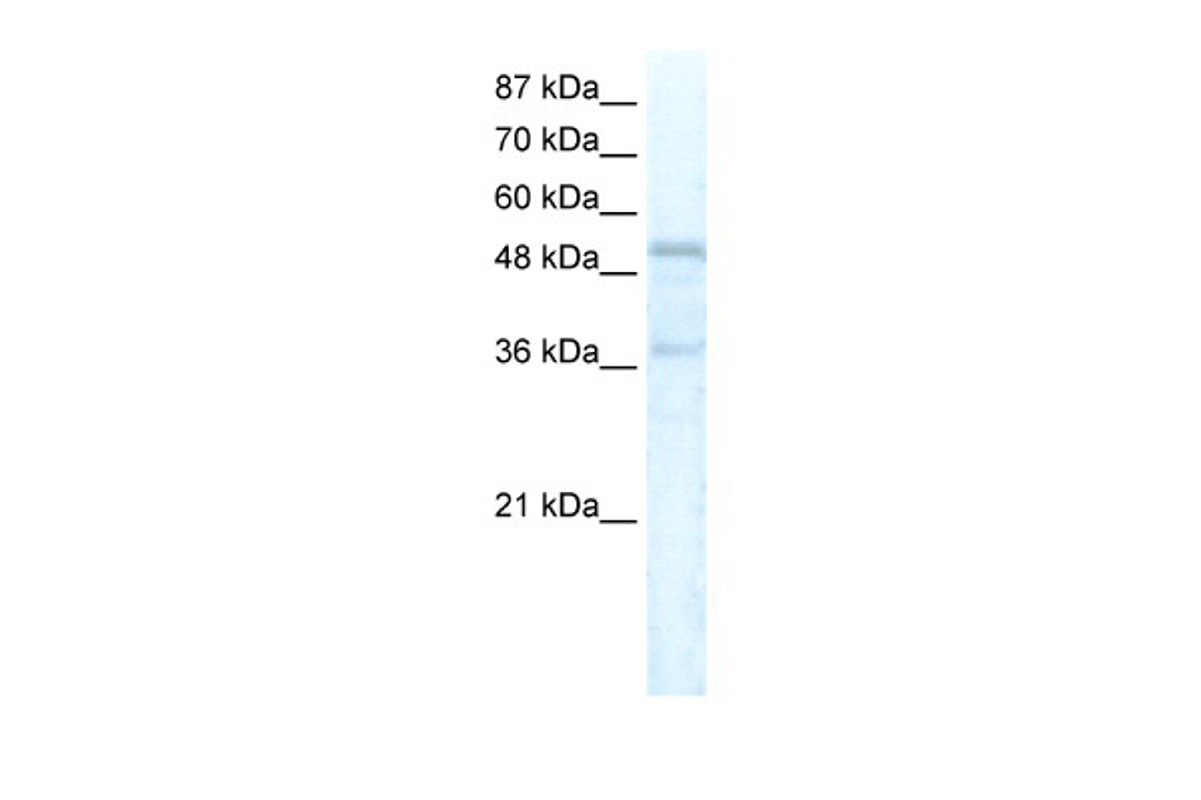 Antibody used in WB on Human HepG2 at 5.0 ug/ml.