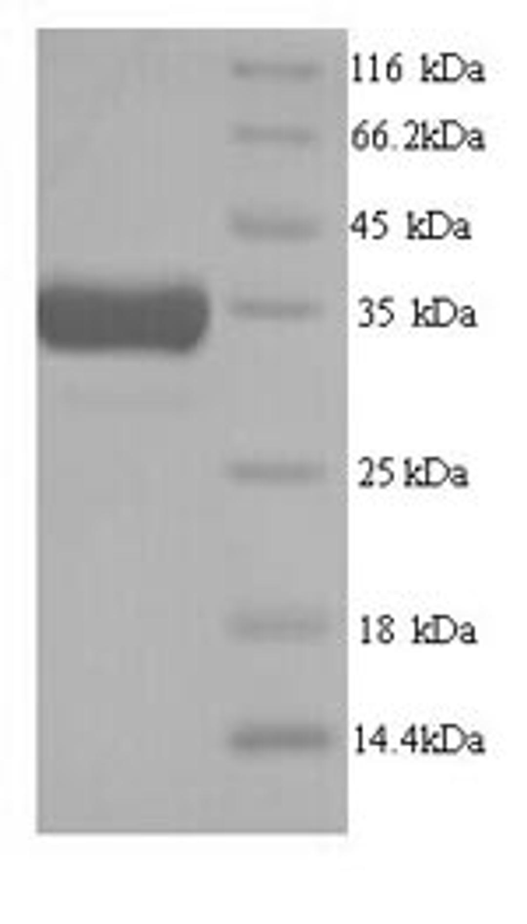 (Tris-Glycine gel) Discontinuous SDS-PAGE (reduced) with 5% enrichment gel and 15% separation gel.