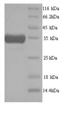 (Tris-Glycine gel) Discontinuous SDS-PAGE (reduced) with 5% enrichment gel and 15% separation gel.