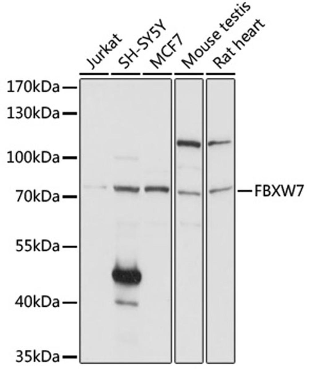 Western blot - FBXW7 antibody (A5872)