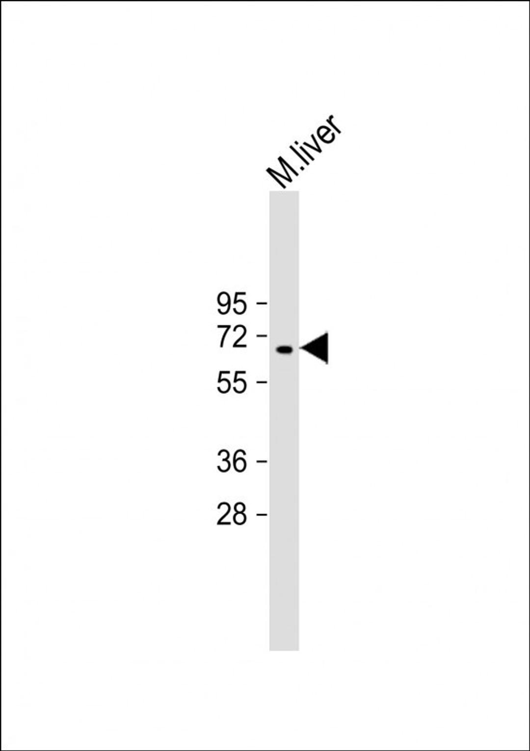 Western Blot at 1:2000 dilution + mouse liver lysate Lysates/proteins at 20 ug per lane.