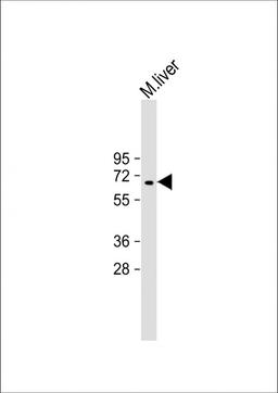 Western Blot at 1:2000 dilution + mouse liver lysate Lysates/proteins at 20 ug per lane.