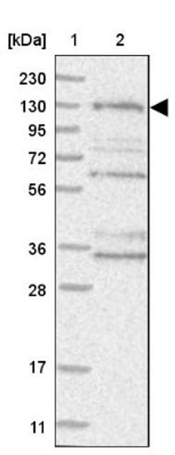 Western Blot: HEATR6 Antibody [NBP1-90877] - Lane 1: Marker [kDa] 230, 130, 95, 72, 56, 36, 28, 17, 11<br/>Lane 2: Human cell line RT-4