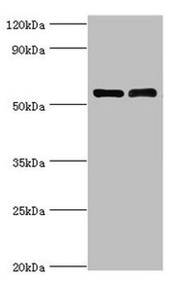Western blot. All lanes: IL7R antibody at 4µg/ml. Lane 1: K562 whole cell lysate. Lane 2: Jurkat whole cell lysate. Secondary. Goat polyclonal to rabbit IgG&nbsp;at 1/10000 dilution. Predicted band size: 52, 35, 30, 29 kDa. Observed band size: 52 kDa&nbsp;