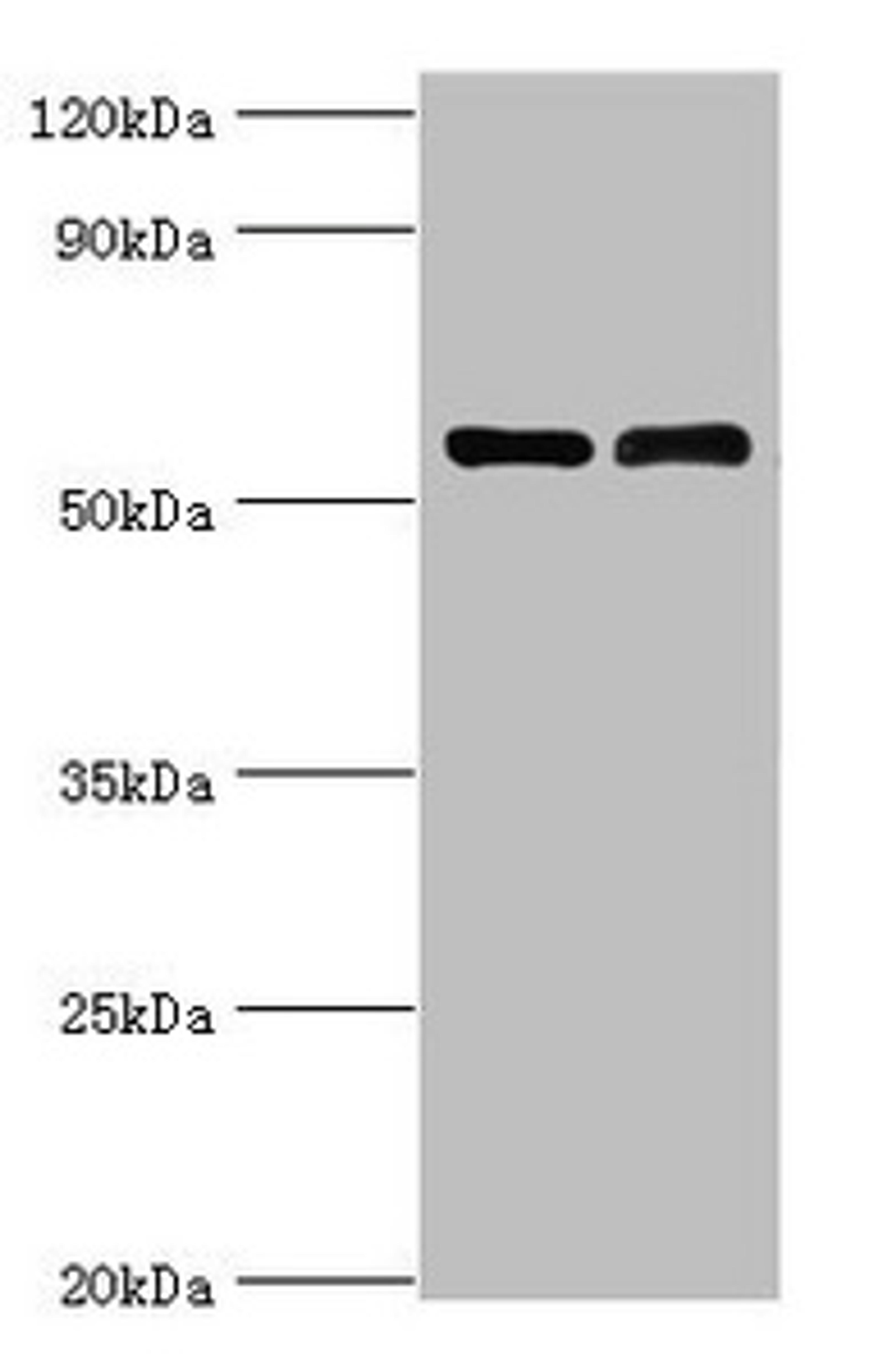 Western blot. All lanes: IL7R antibody at 4µg/ml. Lane 1: K562 whole cell lysate. Lane 2: Jurkat whole cell lysate. Secondary. Goat polyclonal to rabbit IgG&nbsp;at 1/10000 dilution. Predicted band size: 52, 35, 30, 29 kDa. Observed band size: 52 kDa&nbsp;