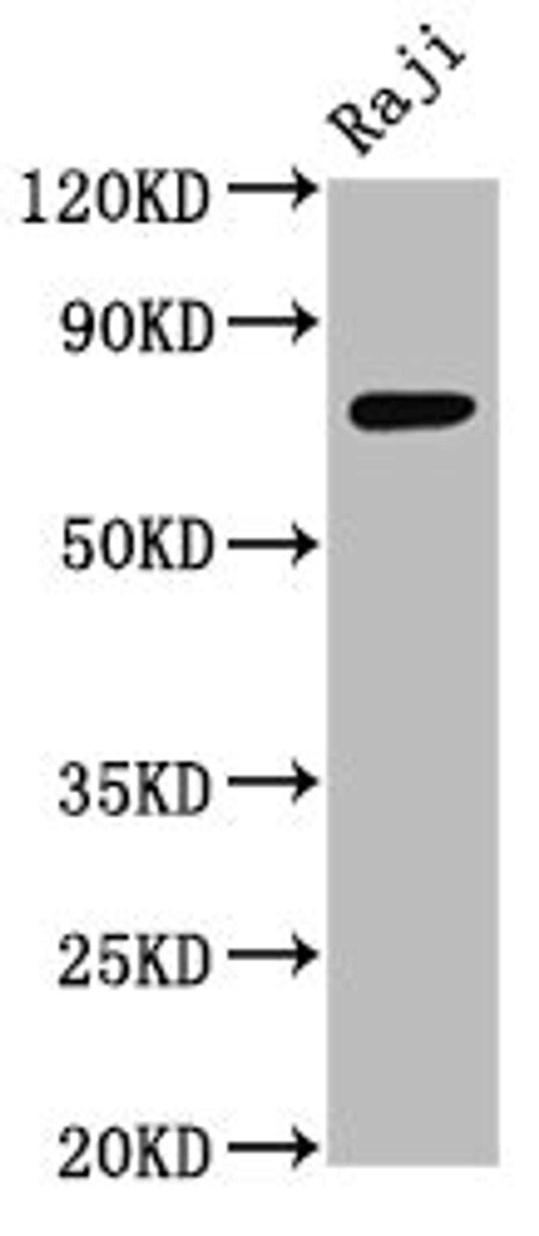 Western Blot. Positive WB detected in: Raji whole cell lysate. All lanes: TSPEAR antibody at 3.5µg/ml. Secondary. Goat polyclonal to rabbit IgG at 1/50000 dilution. Predicted band size: 75, 67 kDa. Observed band size: 75 kDa