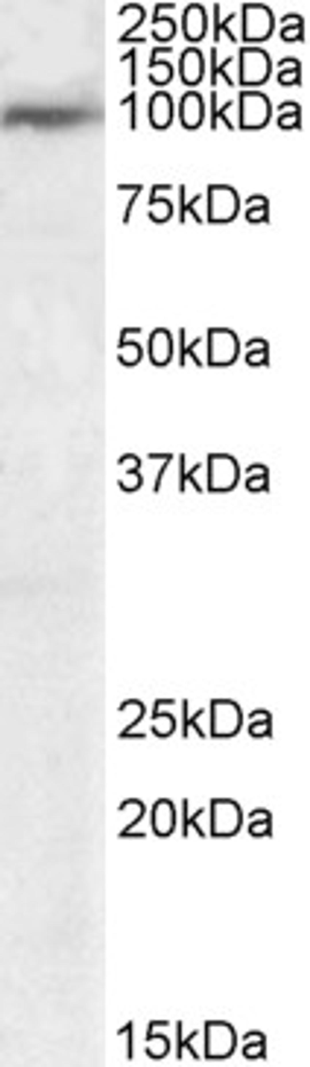 46-558 (1ug/ml) staining of Human Tonsil lysate (35ug protein in RIPA buffer). Primary incubation was 1 hour. Detected by chemiluminescence.