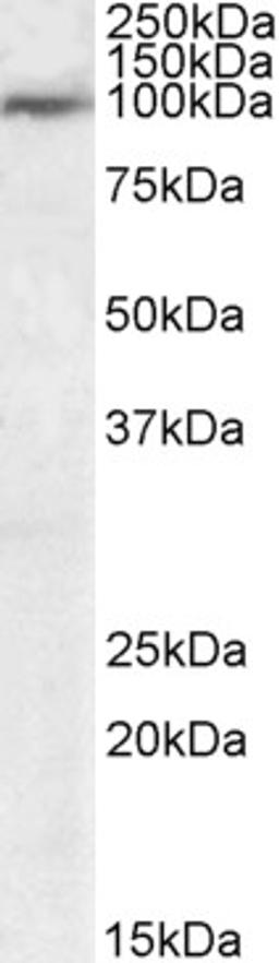 46-558 (1ug/ml) staining of Human Tonsil lysate (35ug protein in RIPA buffer). Primary incubation was 1 hour. Detected by chemiluminescence.