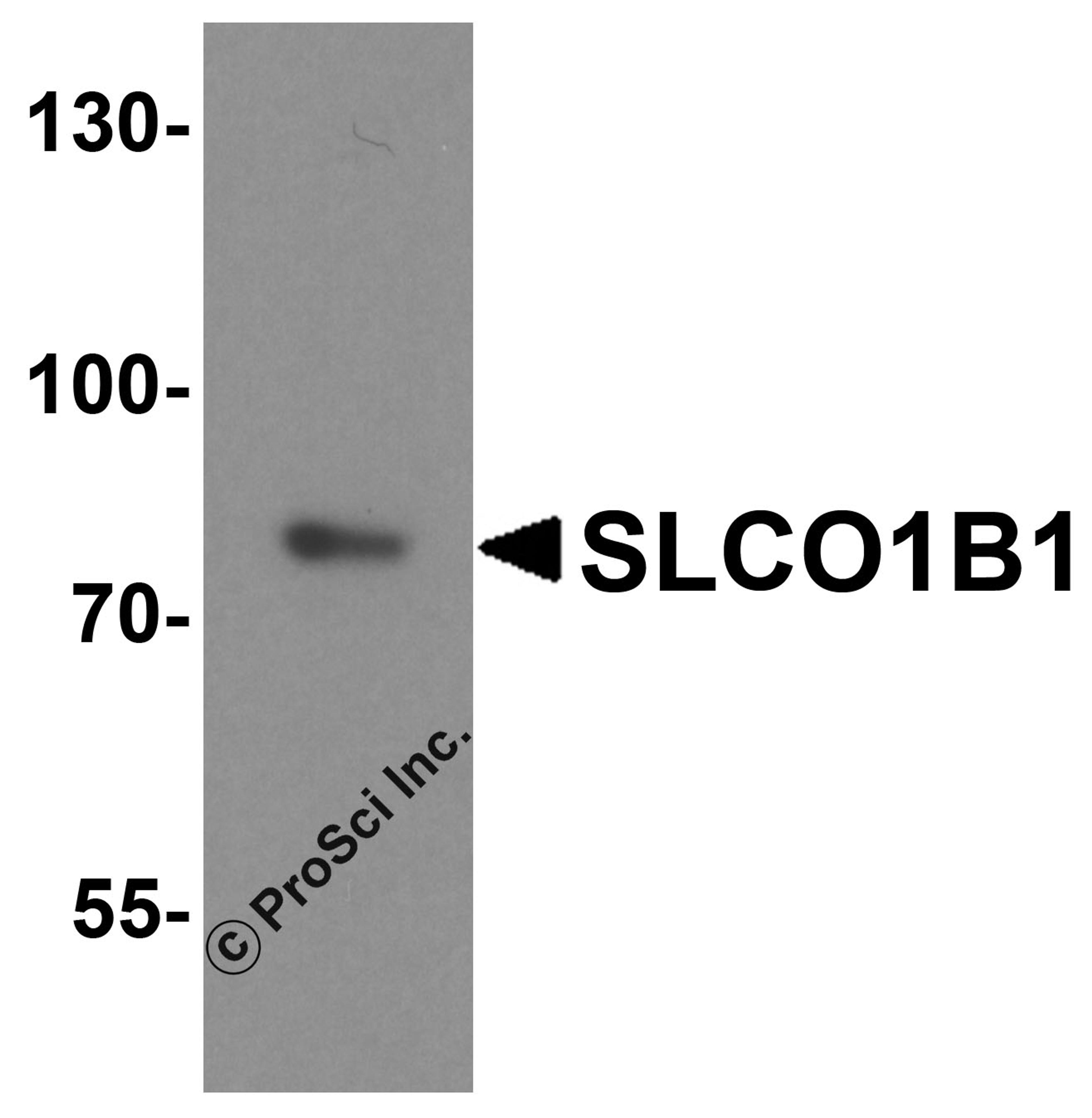 Western blot analysis of SLCO1B1 in human liver tissue lysate with SLCO1B1 antibody at 1 &#956;g/ml.