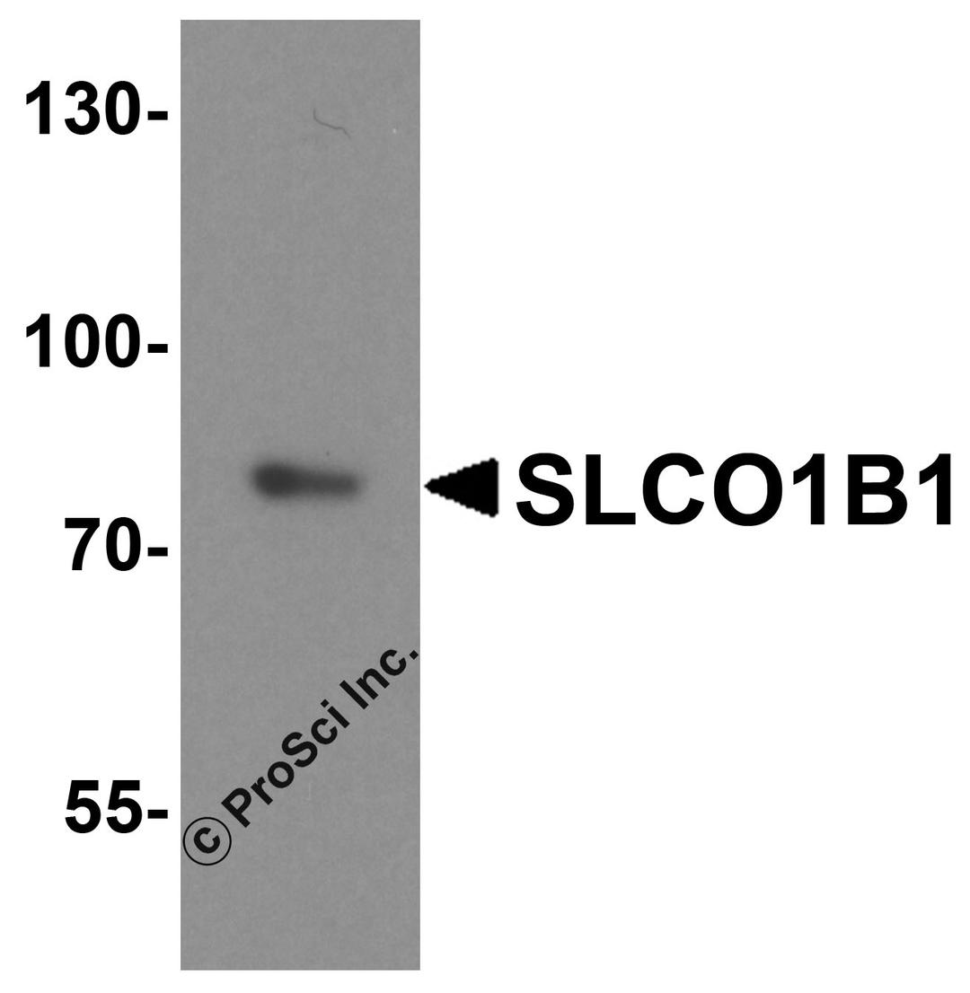 Western blot analysis of SLCO1B1 in human liver tissue lysate with SLCO1B1 antibody at 1 μg/ml.
