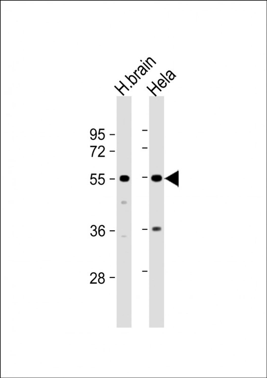 Western Blot at 1:1000 dilution Lane 1: human brain lysate Lane 2: Hela whole cell lysate Lysates/proteins at 20 ug per lane.