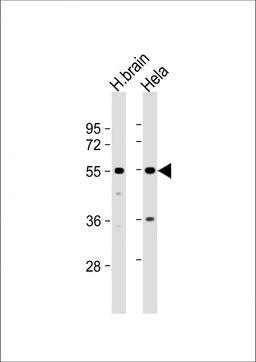 Western Blot at 1:1000 dilution Lane 1: human brain lysate Lane 2: Hela whole cell lysate Lysates/proteins at 20 ug per lane.