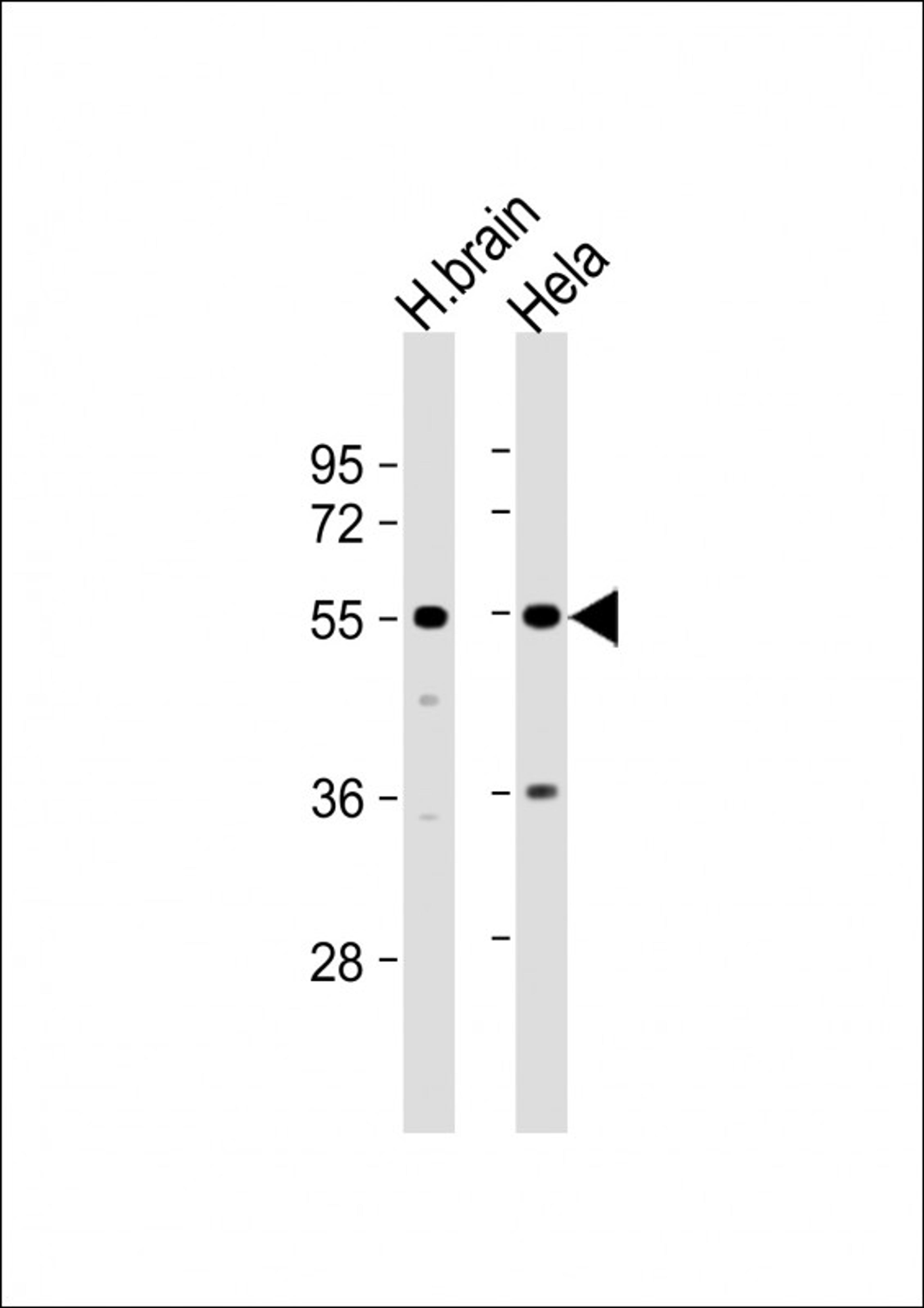 Western Blot at 1:1000 dilution Lane 1: human brain lysate Lane 2: Hela whole cell lysate Lysates/proteins at 20 ug per lane.