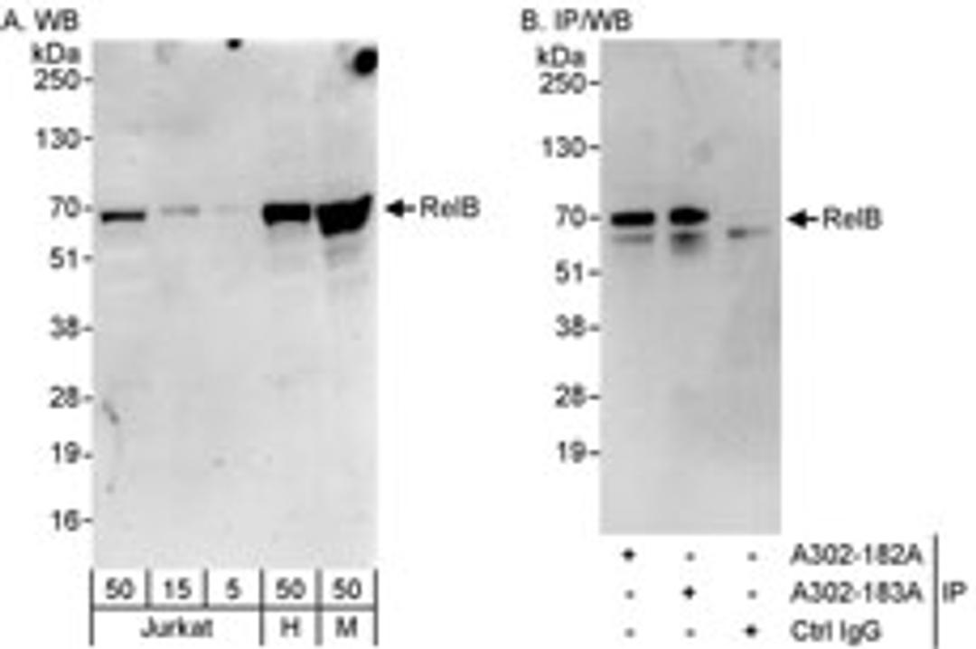 Detection of human and mouse RelB by western blot (h&m) and immunoprecipitation (h).