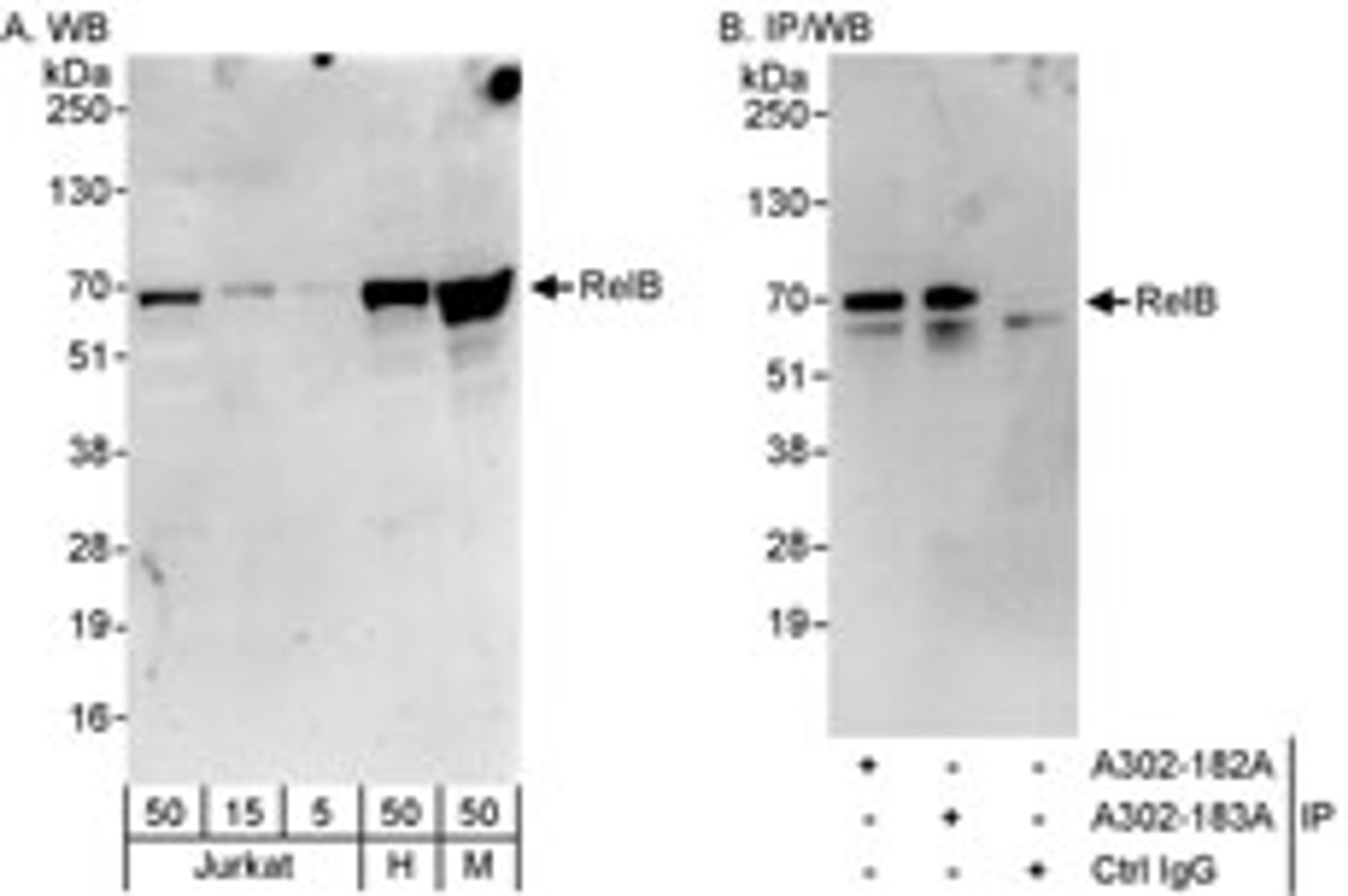 Detection of human and mouse RelB by western blot (h&m) and immunoprecipitation (h).