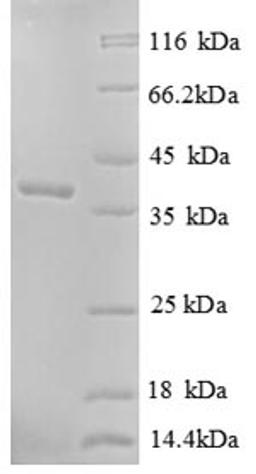 (Tris-Glycine gel) Discontinuous SDS-PAGE (reduced) with 5% enrichment gel and 15% separation gel.