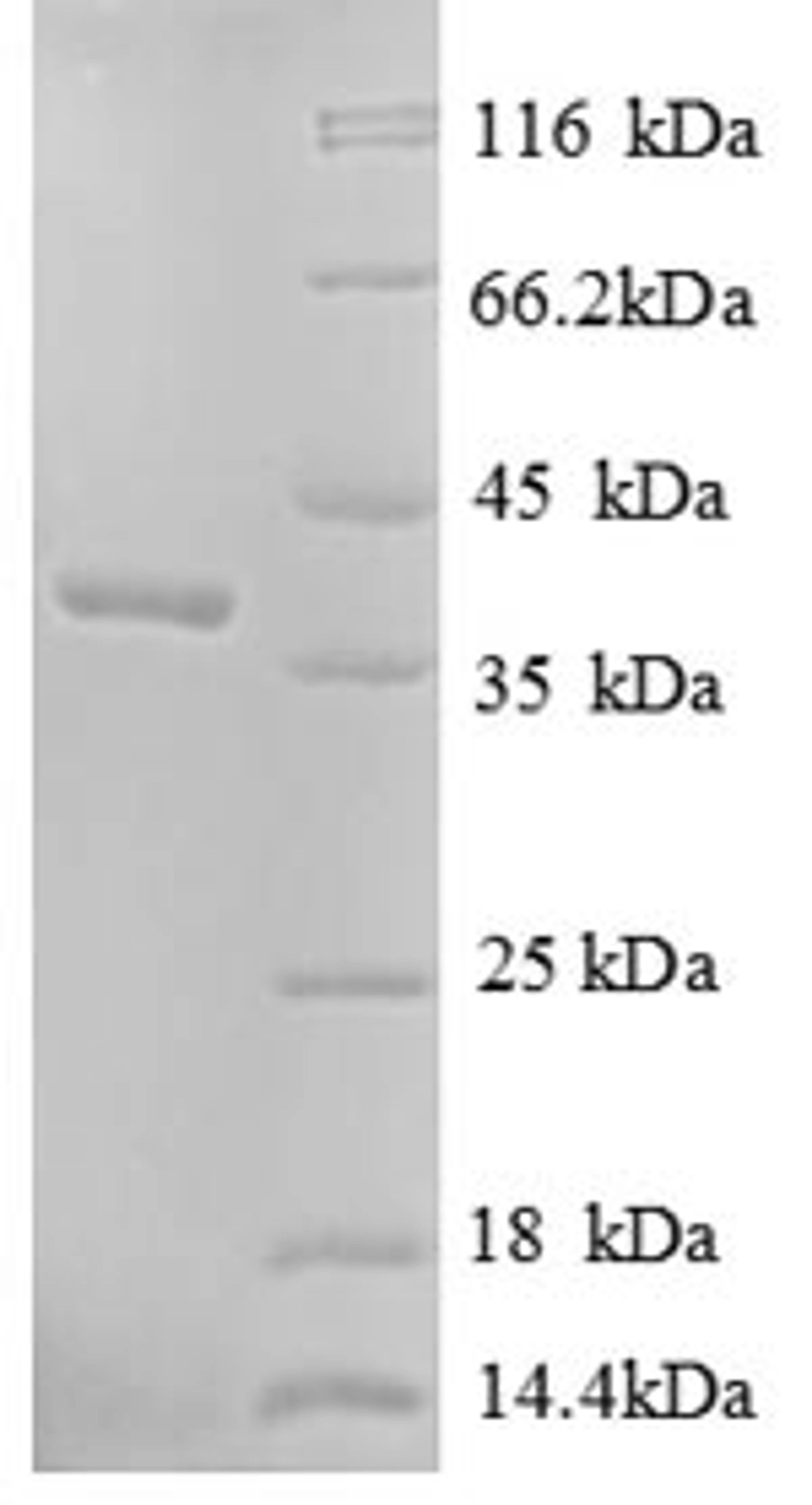 (Tris-Glycine gel) Discontinuous SDS-PAGE (reduced) with 5% enrichment gel and 15% separation gel.