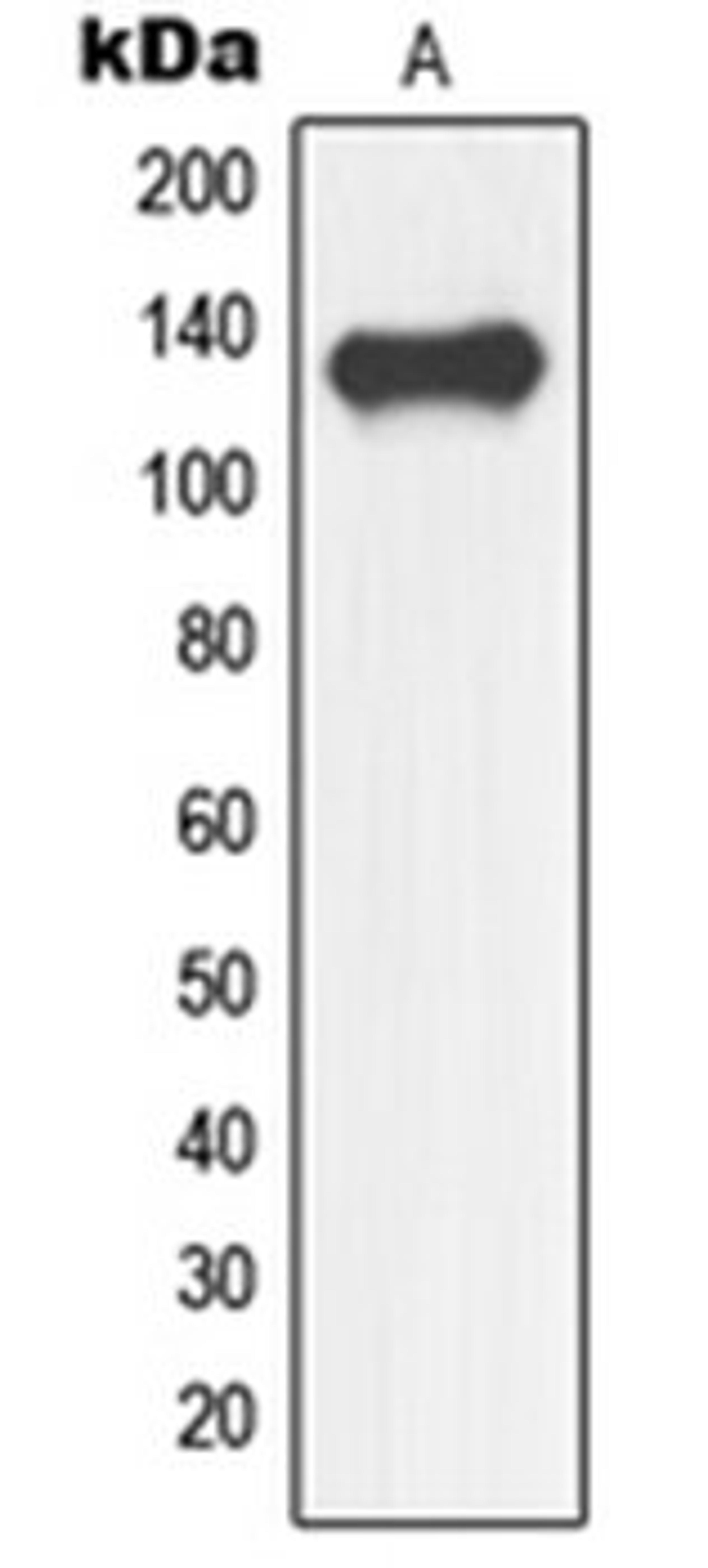 Western blot analysis of human fetal brain (Lane 1) whole cell lysates using NFRKB antibody