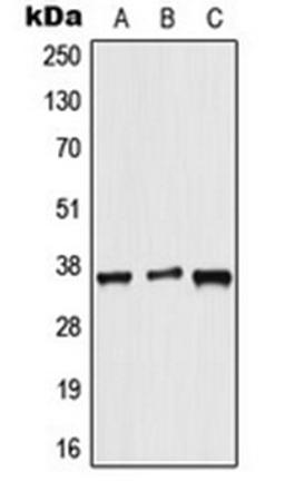 Western blot analysis of HeLa (Lane 1), NIH3T3 (Lane 2), rat brain (Lane 3) whole cell lysates using ALX3 antibody