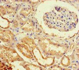 Immunohistochemistry of paraffin-embedded human kidney tissue using CSB-PA007373LA01HU at dilution of 1:100