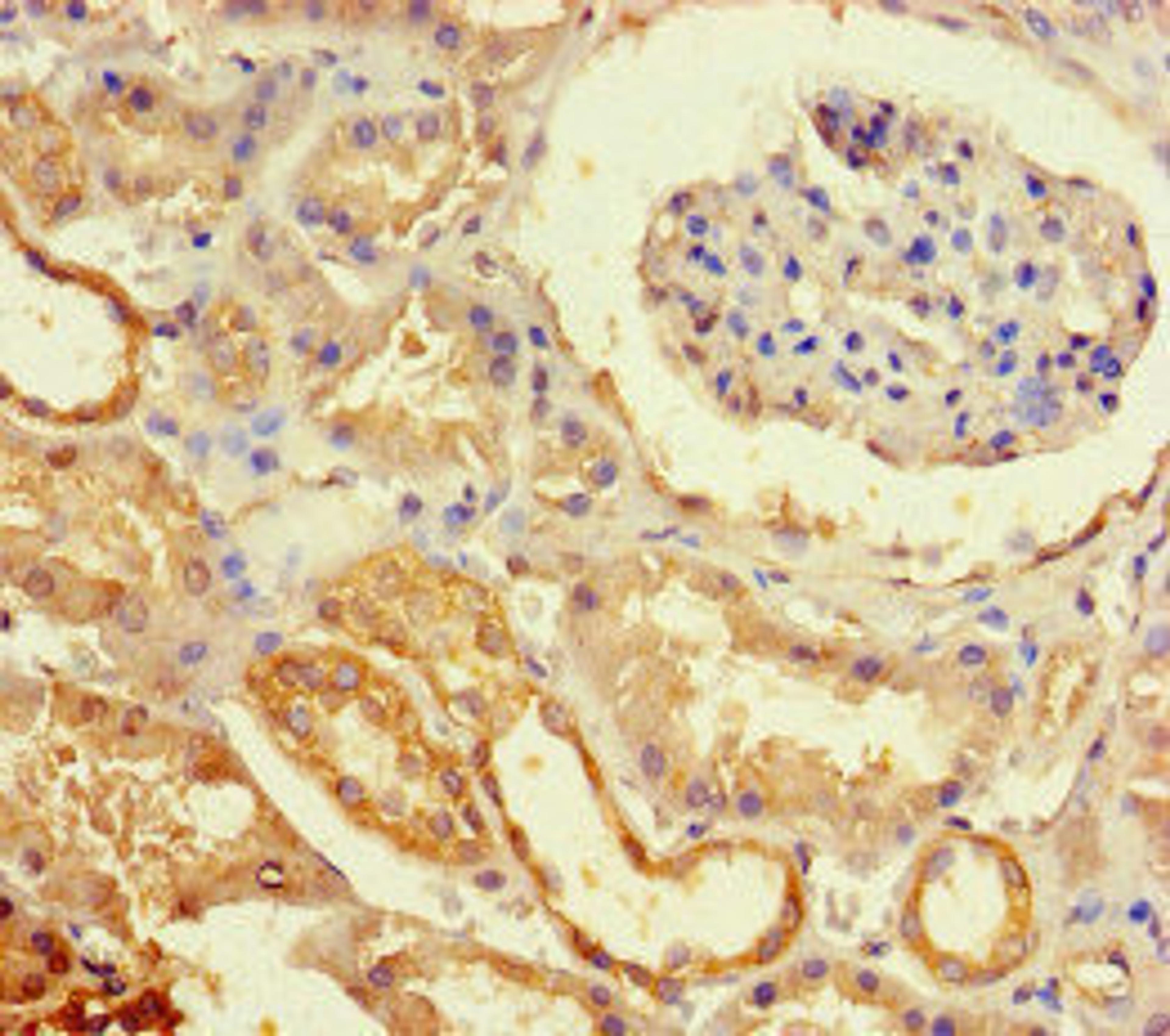 Immunohistochemistry of paraffin-embedded human kidney tissue using CSB-PA007373LA01HU at dilution of 1:100