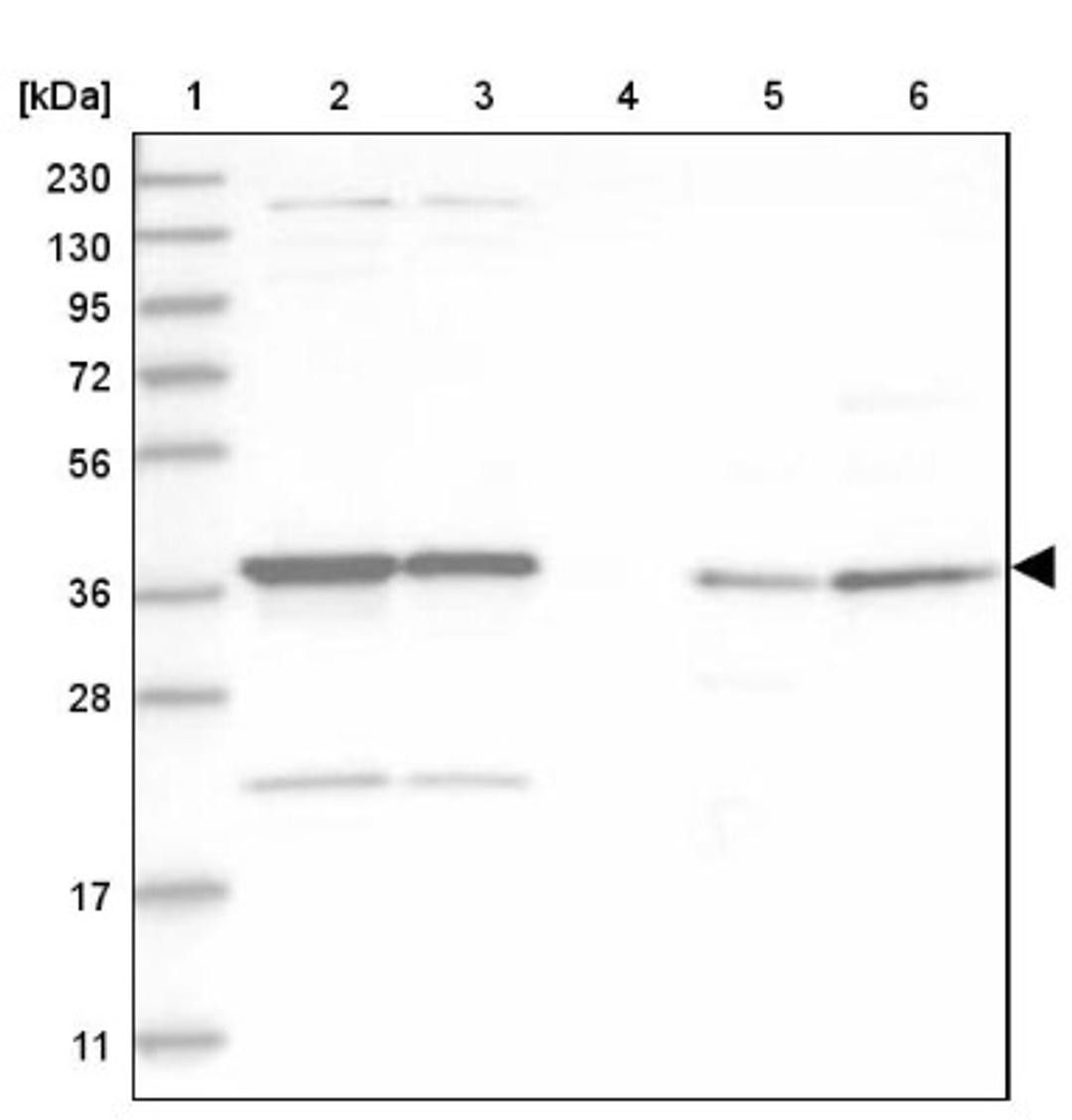 Western Blot: ADPRHL2 Antibody [NBP1-88835] - Lane 1: Marker [kDa] 230, 130, 95, 72, 56, 36, 28, 17, 11<br/>Lane 2: Human cell line RT-4<br/>Lane 3: Human cell line U-251MG sp<br/>Lane 4: Human plasma (IgG/HSA depleted)<br/>Lane 5: Human liver tissue<br/>Lane 6: Human tonsil tissue