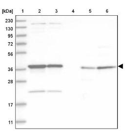 Western Blot: ADPRHL2 Antibody [NBP1-88835] - Lane 1: Marker [kDa] 230, 130, 95, 72, 56, 36, 28, 17, 11<br/>Lane 2: Human cell line RT-4<br/>Lane 3: Human cell line U-251MG sp<br/>Lane 4: Human plasma (IgG/HSA depleted)<br/>Lane 5: Human liver tissue<br/>Lane 6: Human tonsil tissue