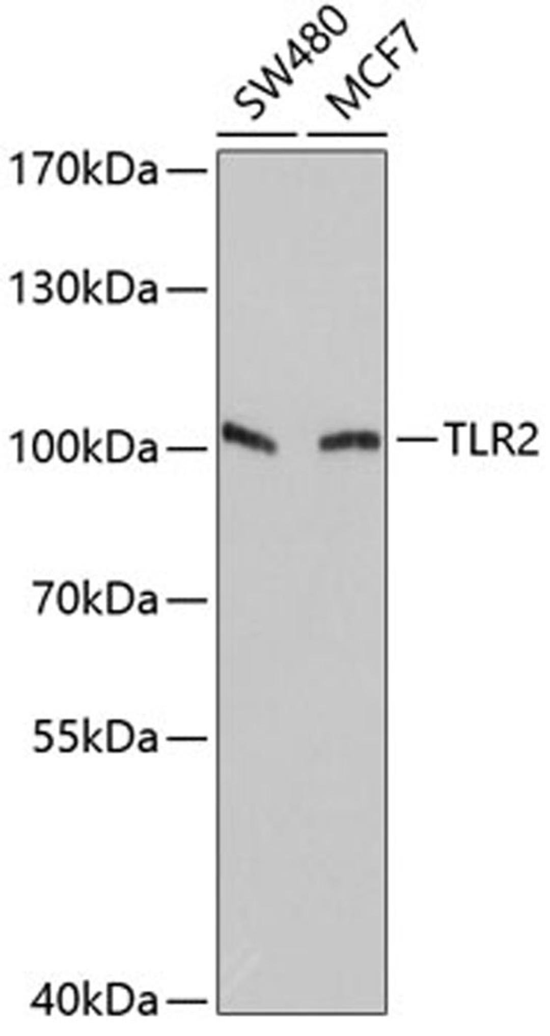 Western blot - TLR2 antibody (A2545)