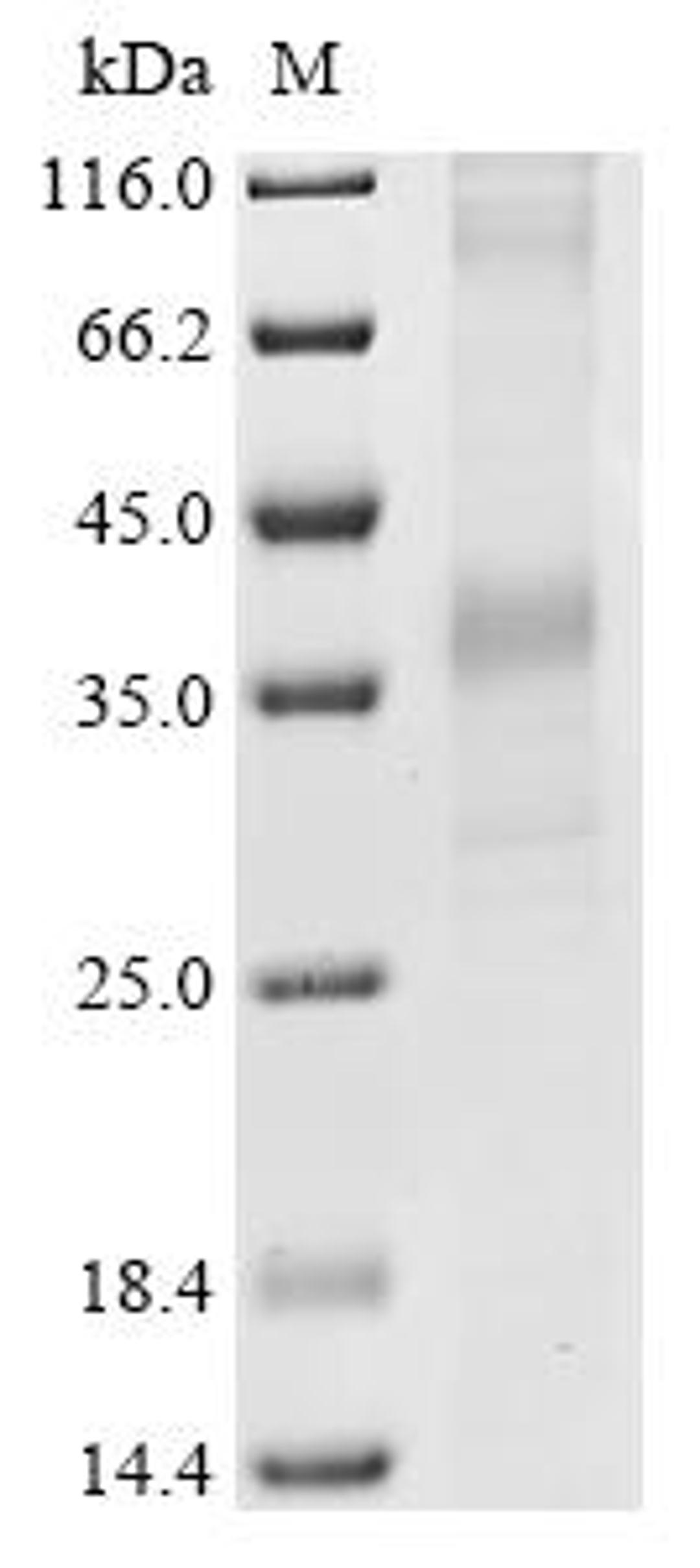 (Tris-Glycine gel) Discontinuous SDS-PAGE (reduced) with 5% enrichment gel and 15% separation gel.