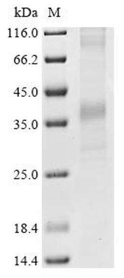 (Tris-Glycine gel) Discontinuous SDS-PAGE (reduced) with 5% enrichment gel and 15% separation gel.